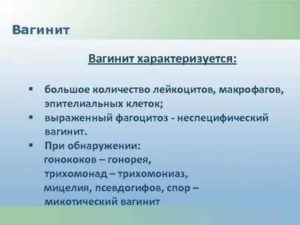 Что такое микотический вагинит