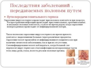 Можно ли заразиться иппп при шугаринге