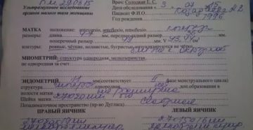 Можно ли делать узи во время месячных отзывы