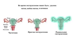 Пульсирует матка при климаксе