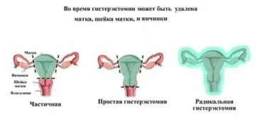 Пульсирует матка при климаксе