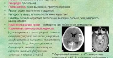 Какие признаки менингита при вич и туберкулезе
