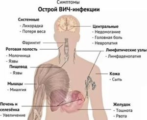 Когда после заражения появляются первые симптомы вич после заражения
