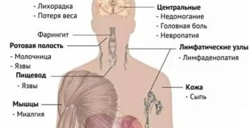 Когда после заражения появляются первые симптомы вич после заражения