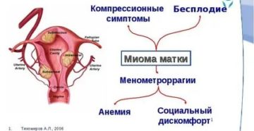 Центр диагностики и лечения миомы матки тихомирова