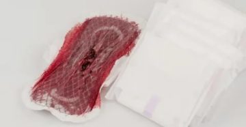 Почему кровь во время месячных темная или светлая Почему кровь во время месячных темная или светлая