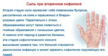 Сколько держится сыпь при сифилисе