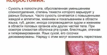Сухость во рту при раке простаты