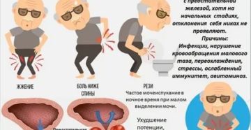 Скрытый простатит как выявить