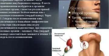Может ли сифилис протекать бессимптомно