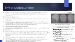 Как лечить энцефалопатию головного мозга при вич