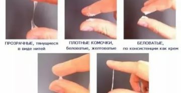 Почему месячных нет и выделения как сопли