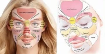 Почему перед месячными появляются прыщи на лице и шее Почему перед месячными появляются прыщи на лице и шее