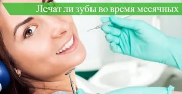 Можно ли лечить зубы с анестезией во время месячных