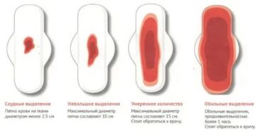 Почему в один месяц месячные обильные а в другой скудные Почему в один месяц месячные обильные а в другой скудные
