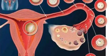Куда девается неоплодотворенная яйцеклетка если нет месячных