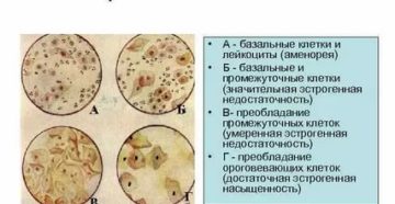 Что такое кольпоцитология шейки матки