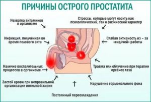 Можно ли заниматься сексом во время лечения простатита антибиотиками