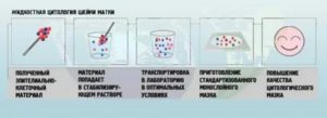 Что показывает жидкостная цитология шейки матки отзывы