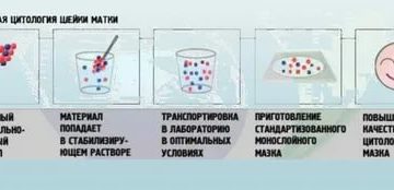 Что показывает жидкостная цитология шейки матки отзывы