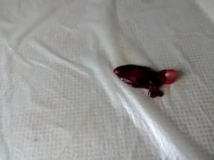 Почему эмбрион не выходит с месячными