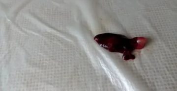 Почему эмбрион не выходит с месячными Почему эмбрион не выходит с месячными