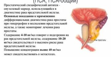 Маркер предстательной железы норма