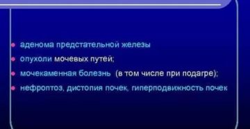Нарушение уродинамики предстательной железы