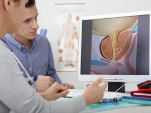 Лечение рака простаты 4 степени асд