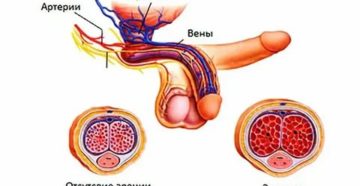 Что сделать чтобы остановить эрекцию