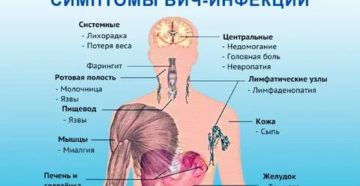 Как лечить горло при вич инфекции