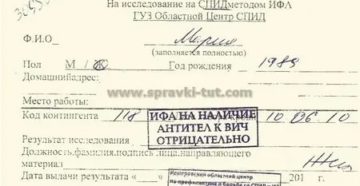 Сколько по времени делается анализ на вич в центре спида