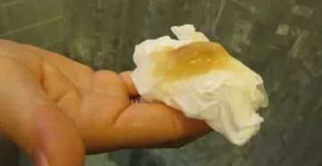 Когда отходит слизистая пробка перед месячными