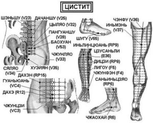 Какую точку массировать при цистите
