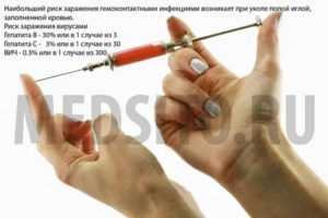 Можно ли заразиться вич и гепатитом случайно уколовшись иглой на улице