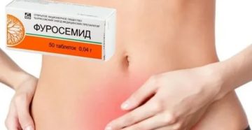 Может при цистите быть отечность