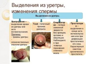 Выделения из мочеиспускательного канала у мужчин при простатите