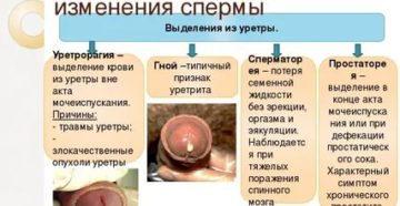 Выделения из мочеиспускательного канала у мужчин при простатите