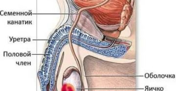 Из за чего образуется опухоль на семенном канатике