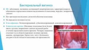 Можно ли забеременеть после гарднереллеза