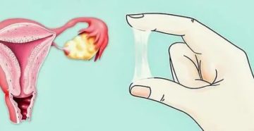 Что делать если во время месячных раздражение Что делать если во время месячных раздражение