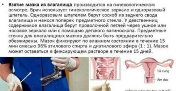 Может ли мазок из влагалища показать сифилис