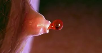 Когда лопается фолликул и начинаются месячные