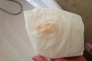 Могут ли быть розовые выделения при цистите у