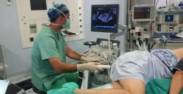Узи предстательной железы ректальным датчиком что это