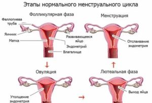 Можно ли забеременеть если есть нарушение менструального цикла