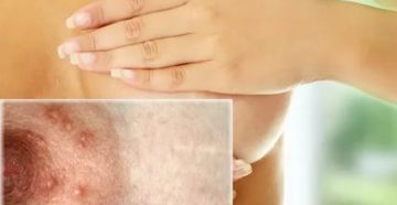 Почему чешется соски во время месячных Почему чешется соски во время месячных