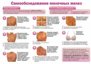 Как идут месячные при раке молочной железы