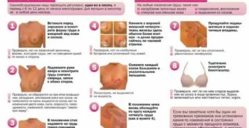 Как идут месячные при раке молочной железы