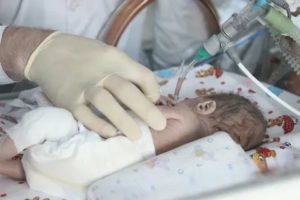Почему дети рождаются 7 месячные дети